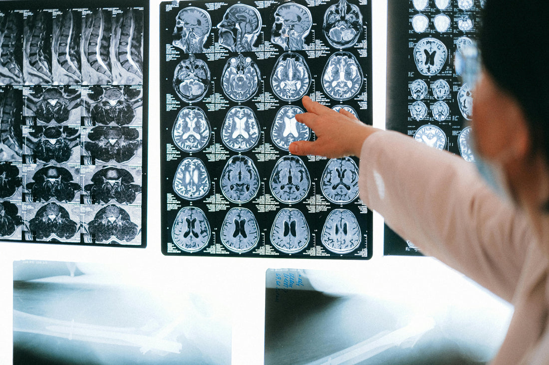 A series of various medical scans with a women pointing at it