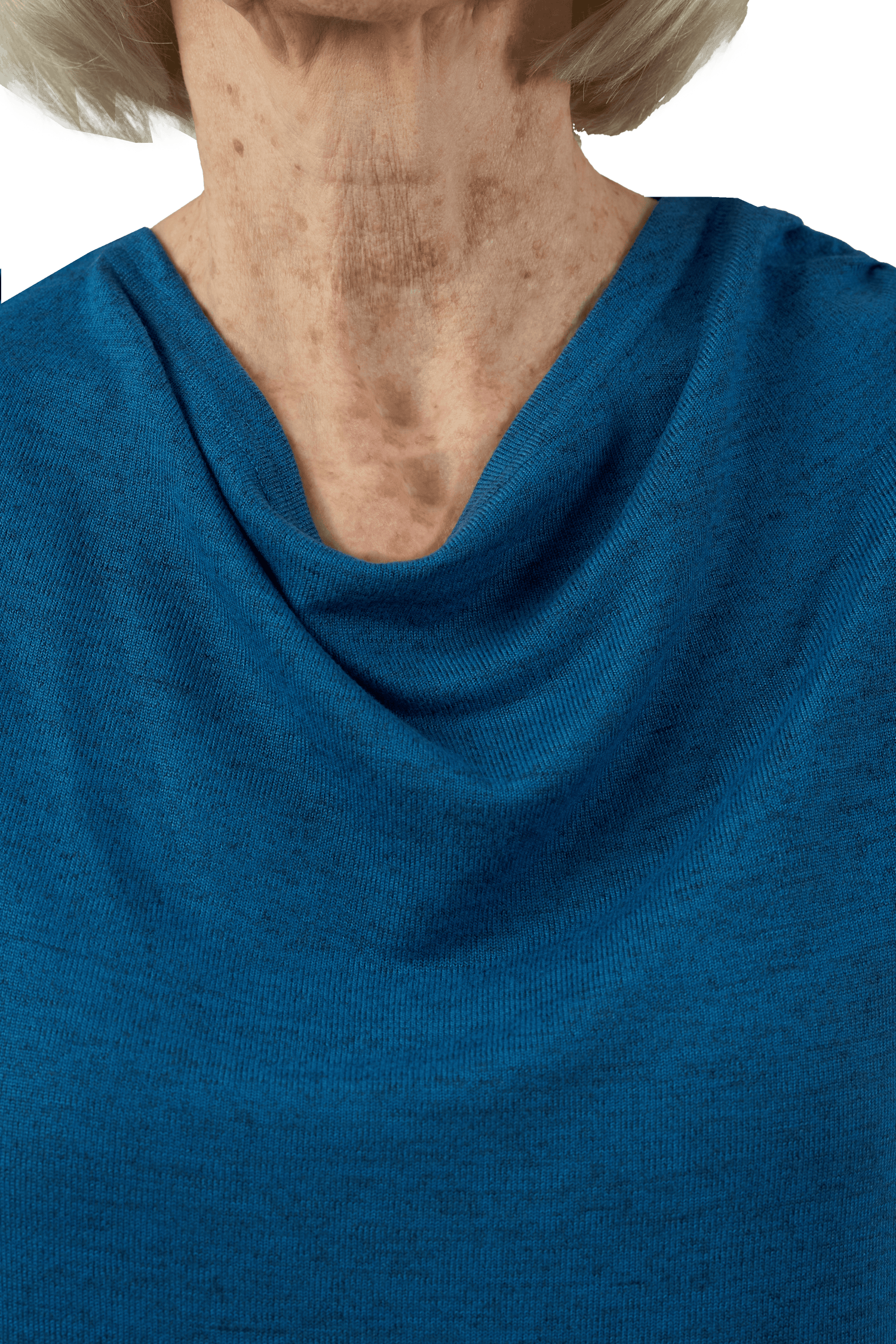 Adaptive Top - Annie | Azur, front detail