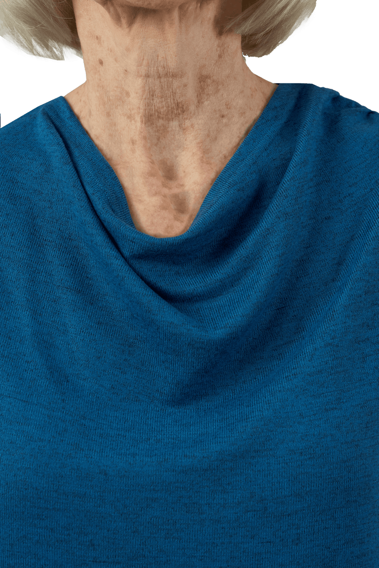 Adaptive Top - Annie | Azur, front detail