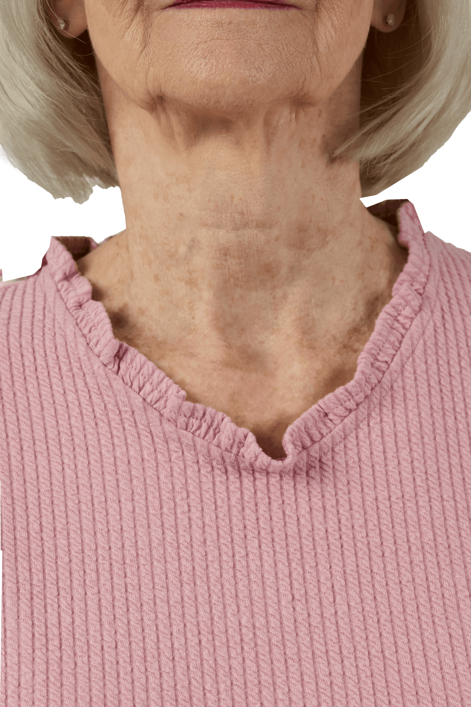 Adaptive Top - Rosie | Pink, neckline detail